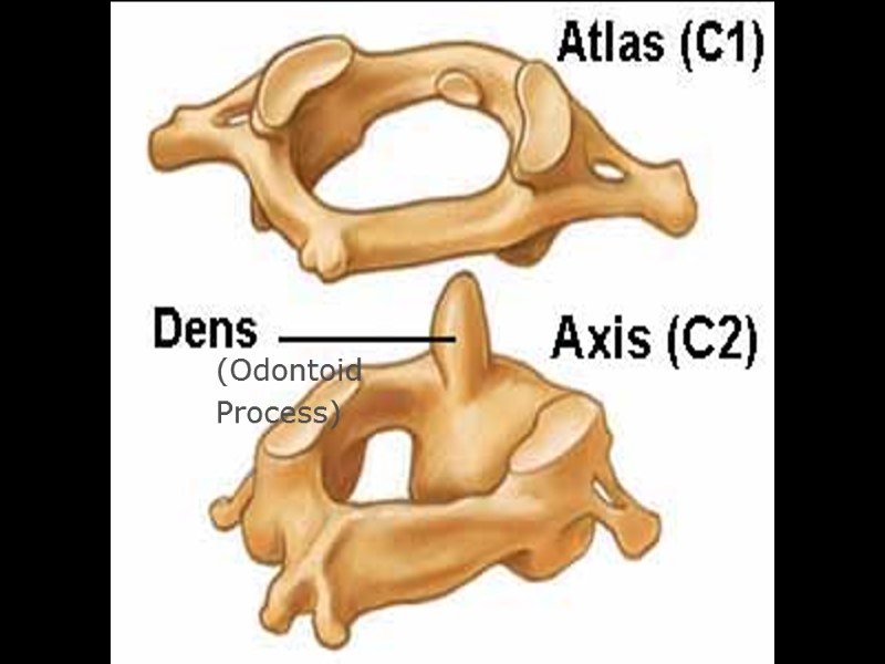 (Odontoid  Process)